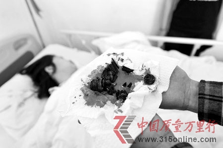 經(jīng)過(guò)搶救后,女子脫離了生命危險(xiǎn),但依然非常虛弱,連說(shuō)話的力氣也沒(méi)有。醫(yī)生在手術(shù)中,從該女子體內(nèi)取出一二十塊碎片,其中包括鐵環(huán)、螺絲和大塑料塊等,觸目驚心。 CFP 經(jīng)過(guò)搶救后,女子脫離了生命危險(xiǎn),但依然非常虛弱,連說(shuō)話的力氣也沒(méi)有。醫(yī)生在手術(shù)中,從該女子體內(nèi)取出一二十塊碎片,其中包括鐵環(huán)、螺絲和大塑料塊等,觸目驚心。 CFP